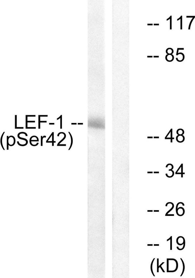 Phospho-LEF1 (Ser42) Antibody in Western Blot (WB)