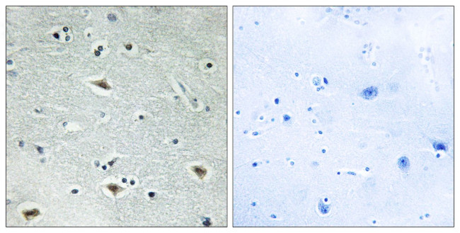 MTG16 Antibody in Immunohistochemistry (Paraffin) (IHC (P))