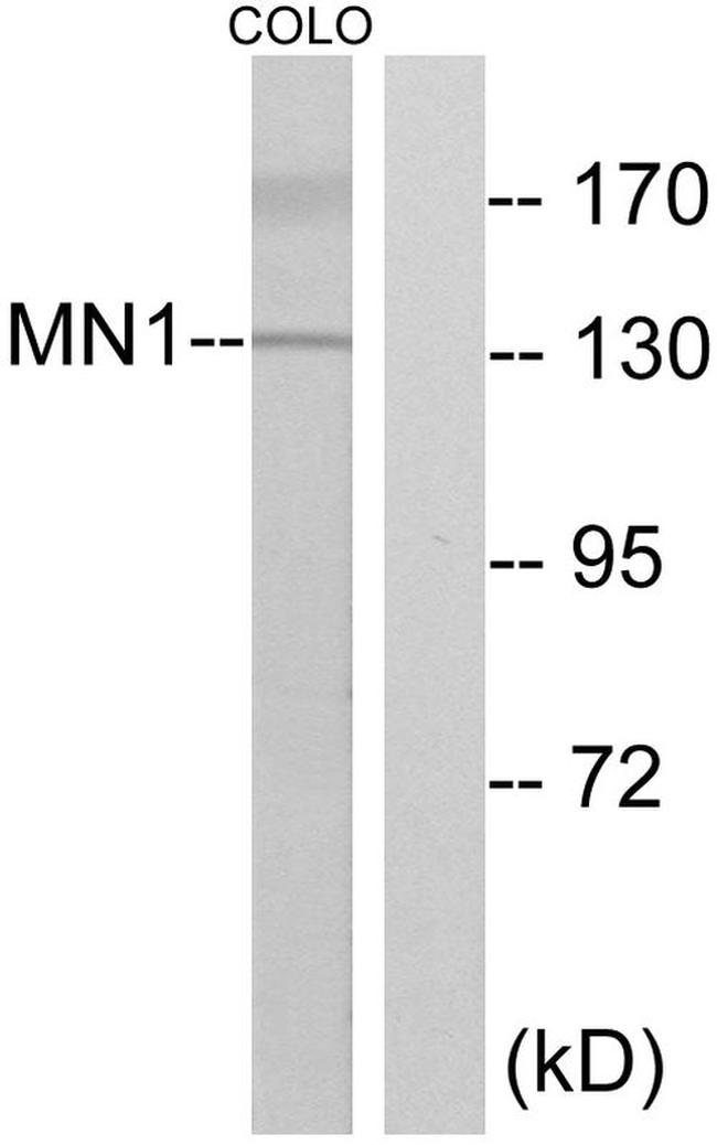 MN1 Antibody in Western Blot (WB)
