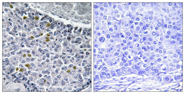 Phospho-MAD1 (Ser428) Antibody in Immunohistochemistry (Paraffin) (IHC (P))