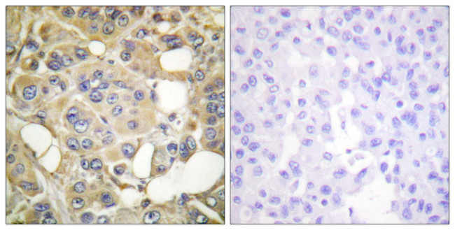 Phospho-MARK Pan (Thr215) Antibody in Immunohistochemistry (Paraffin) (IHC (P))
