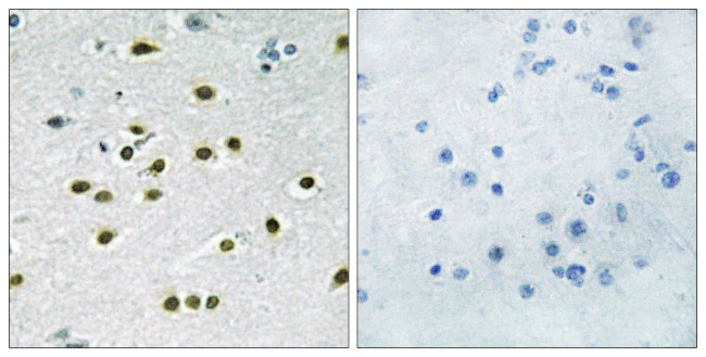 KLF10/KLF11 Antibody in Immunohistochemistry (Paraffin) (IHC (P))