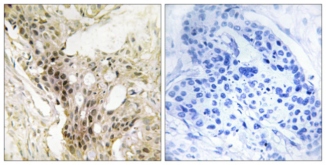MED21 Antibody in Immunohistochemistry (Paraffin) (IHC (P))