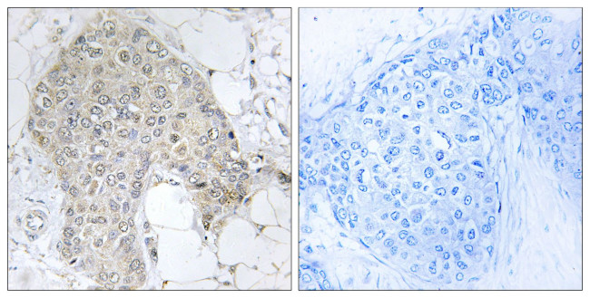 PPP1R2 Antibody in Immunohistochemistry (Paraffin) (IHC (P))