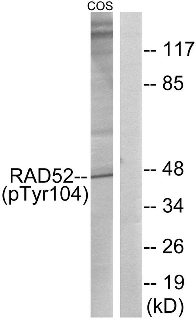Phospho-RAD52 (Tyr104) Antibody in Western Blot (WB)