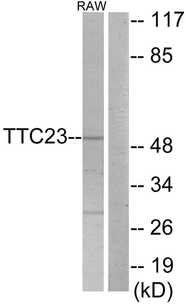 TTC23 Antibody in Western Blot (WB)