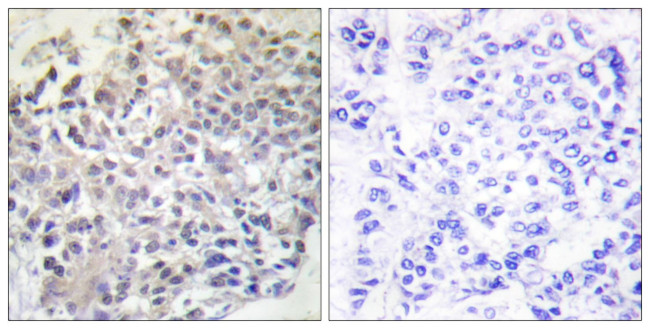 RAPGEF1 Antibody in Immunohistochemistry (Paraffin) (IHC (P))