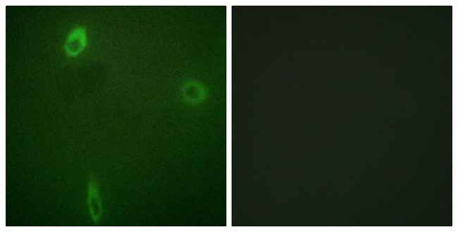 Phospho-Kir1.1 (Ser25, Ser44) Antibody in Immunocytochemistry (ICC/IF)