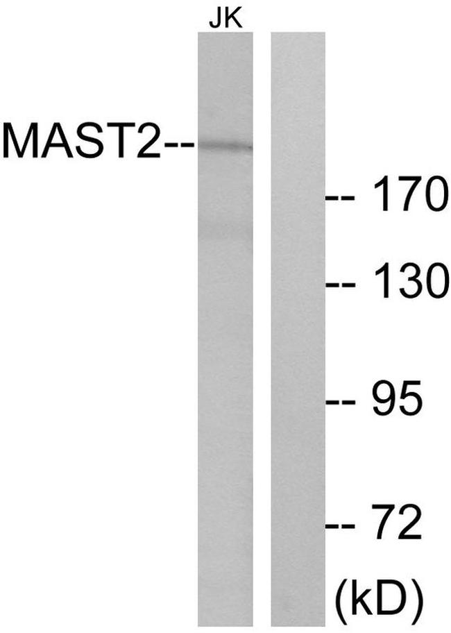 MAST2 Antibody in Western Blot (WB)