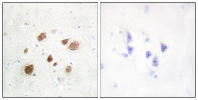 PNCK Antibody in Immunohistochemistry (Paraffin) (IHC (P))