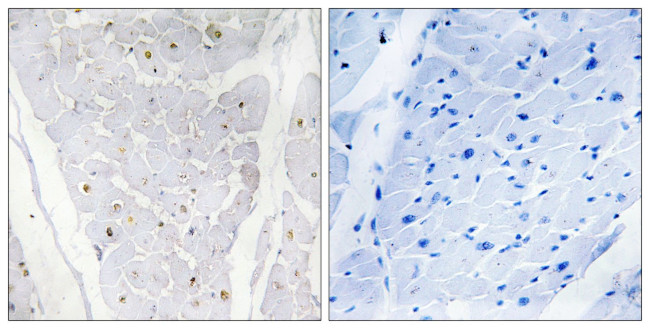 ALPK2 Antibody in Immunohistochemistry (Paraffin) (IHC (P))