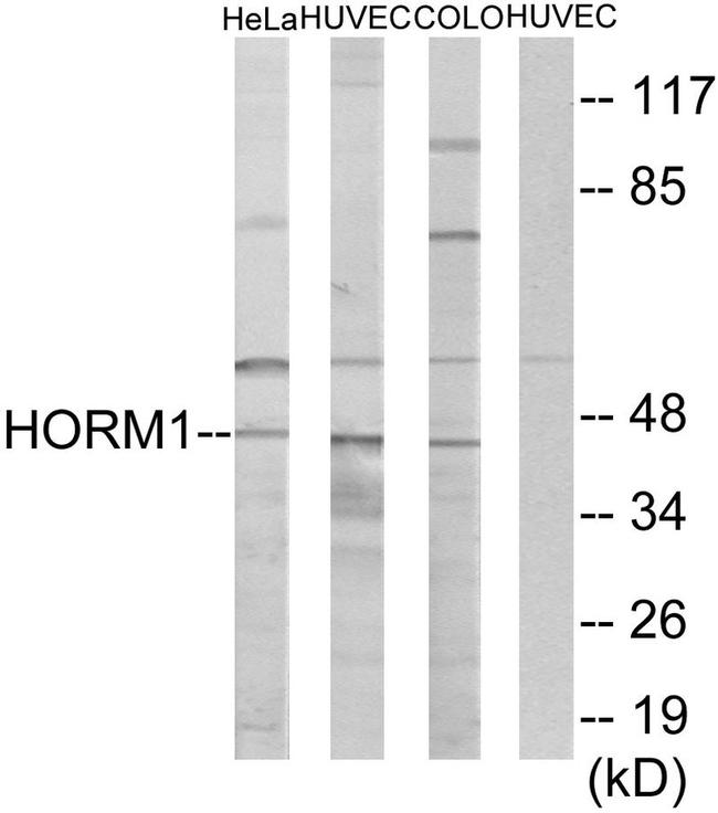 HORMAD1 Antibody in Western Blot (WB)
