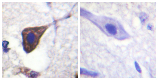 Phospho-beta-2 Adrenergic Receptor (Ser346) Antibody in Immunohistochemistry (Paraffin) (IHC (P))