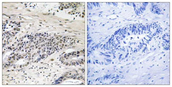 Phospho-Aurora A (Ser342) Antibody in Immunohistochemistry (Paraffin) (IHC (P))