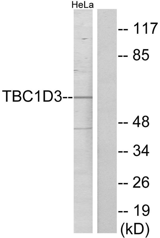 TBC1D3 Antibody in Western Blot (WB)