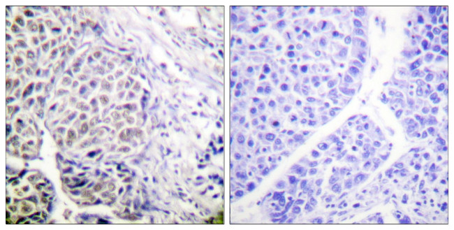 Phospho-Aurora B (Tyr12) Antibody in Immunohistochemistry (Paraffin) (IHC (P))