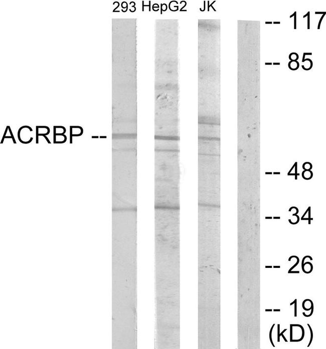 ACRBP Antibody in Western Blot (WB)