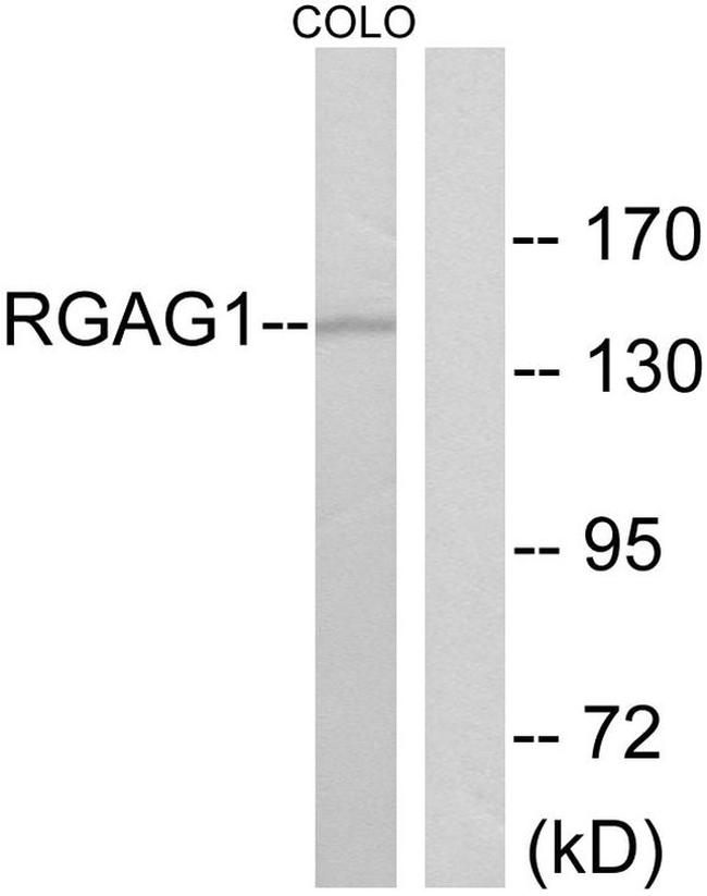 RGAG1 Antibody in Western Blot (WB)