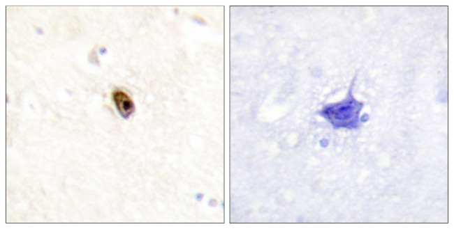 Phospho-Aurora C (Thr236, Thr202) Antibody in Immunohistochemistry (Paraffin) (IHC (P))