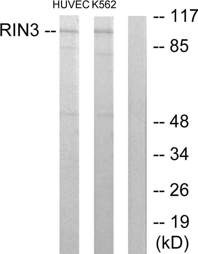 RIN3 Antibody in Western Blot (WB)