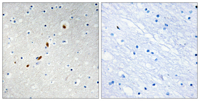 ZNF596 Antibody in Immunohistochemistry (Paraffin) (IHC (P))