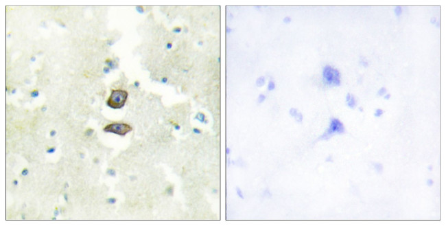 BRI3BP Antibody in Immunohistochemistry (Paraffin) (IHC (P))