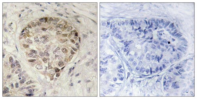 Phospho-CENTB1 (Ser554) Antibody in Immunohistochemistry (Paraffin) (IHC (P))