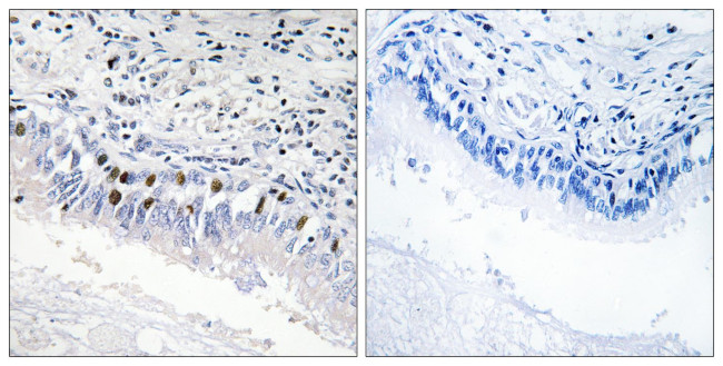 MED12 Antibody in Immunohistochemistry (Paraffin) (IHC (P))