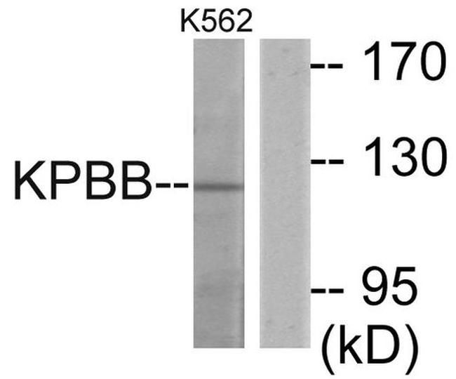 PHKB Antibody in Western Blot (WB)