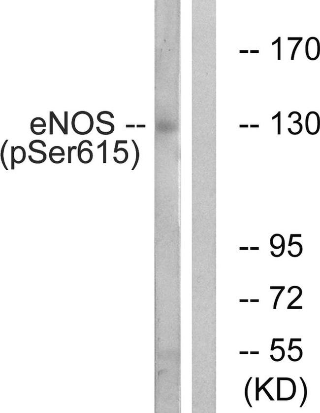 Phospho-eNOS (Ser615) Antibody in Western Blot (WB)