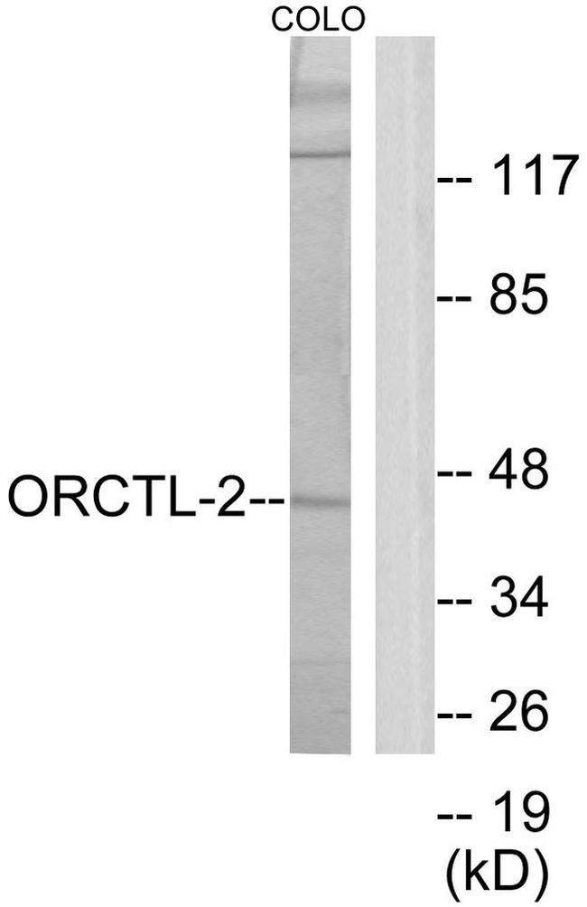 SLC22A18 Antibody in Western Blot (WB)