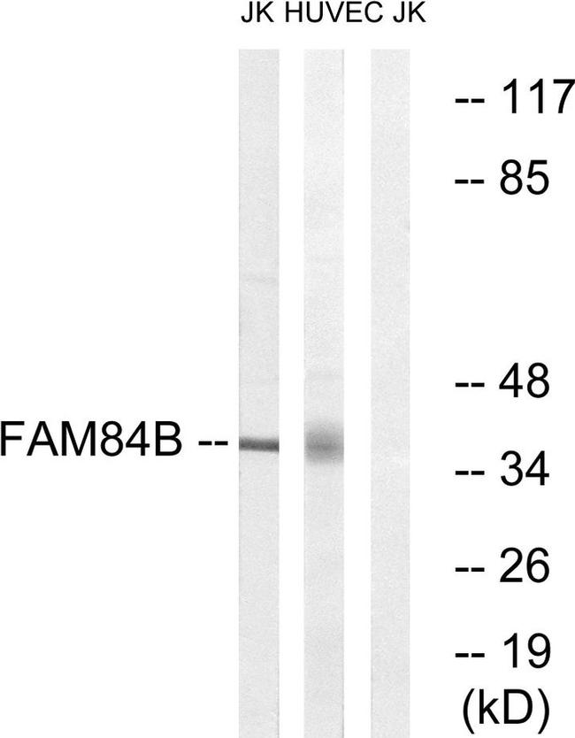 FAM84B Antibody in Western Blot (WB)
