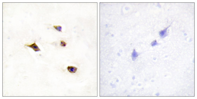 IP6K3 Antibody in Immunohistochemistry (Paraffin) (IHC (P))