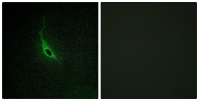ARHGEF17 Antibody in Immunocytochemistry (ICC/IF)