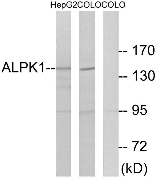ALPK1 Antibody in Western Blot (WB)