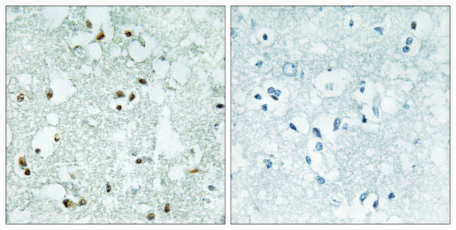 ELAC2 Antibody in Immunohistochemistry (Paraffin) (IHC (P))