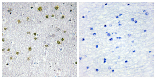 NRIP2 Antibody in Immunohistochemistry (Paraffin) (IHC (P))