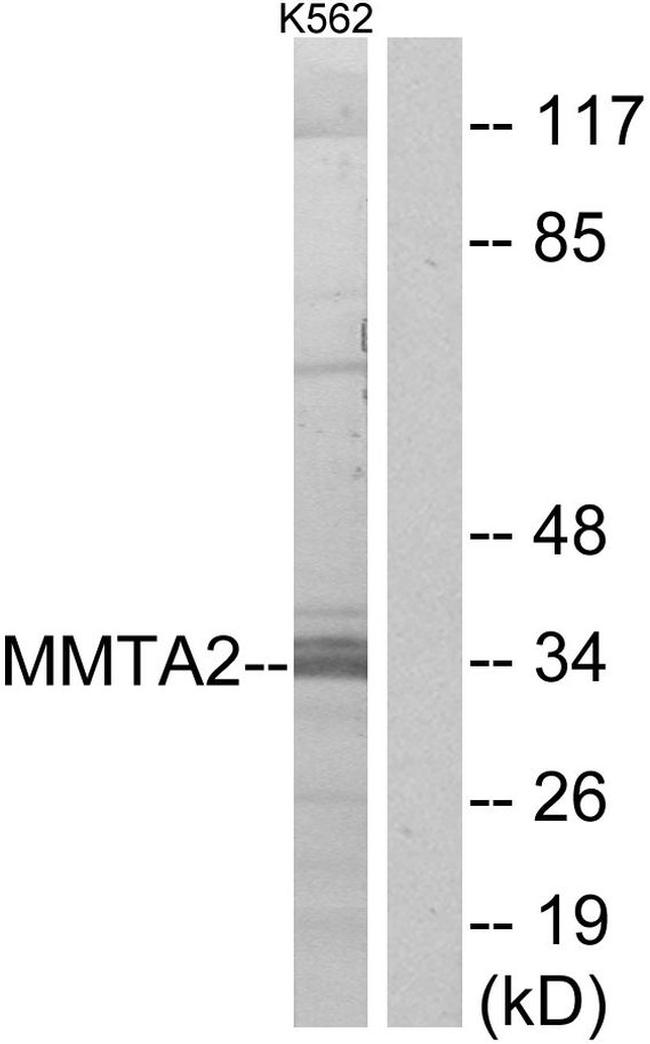 MMTAG2 Antibody in Western Blot (WB)