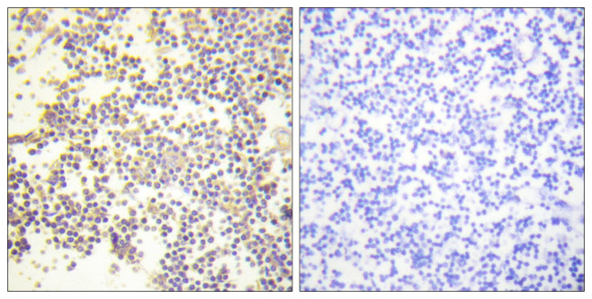 Phospho-p47phox (Ser328) Antibody in Immunohistochemistry (Paraffin) (IHC (P))