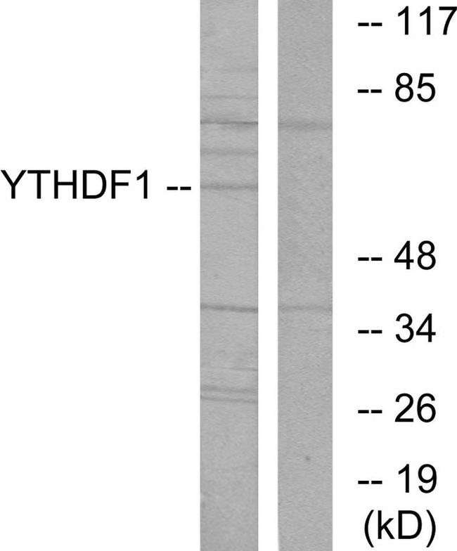 YTHDF1 Antibody in Western Blot (WB)