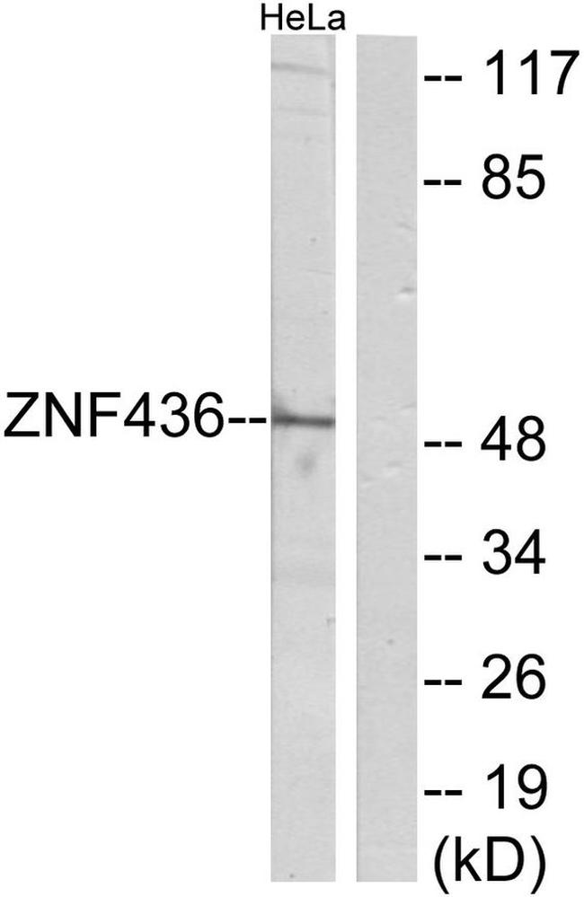 ZNF436 Antibody in Western Blot (WB)