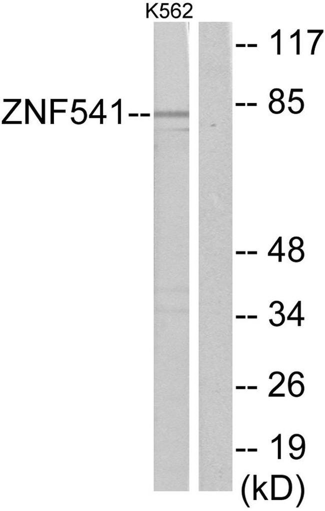 ZNF541 Antibody in Western Blot (WB)