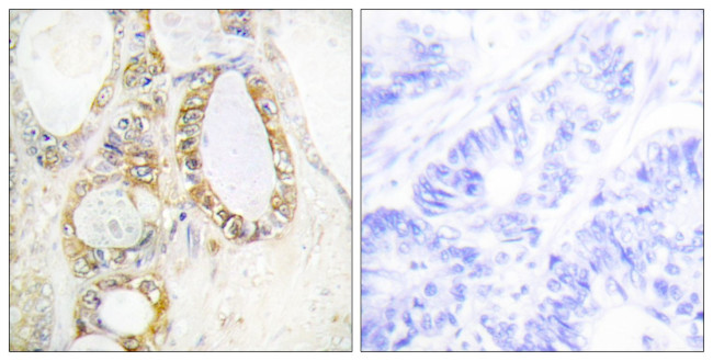 MUC13 Antibody in Immunohistochemistry (Paraffin) (IHC (P))