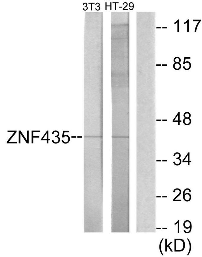 ZNF435 Antibody in Western Blot (WB)