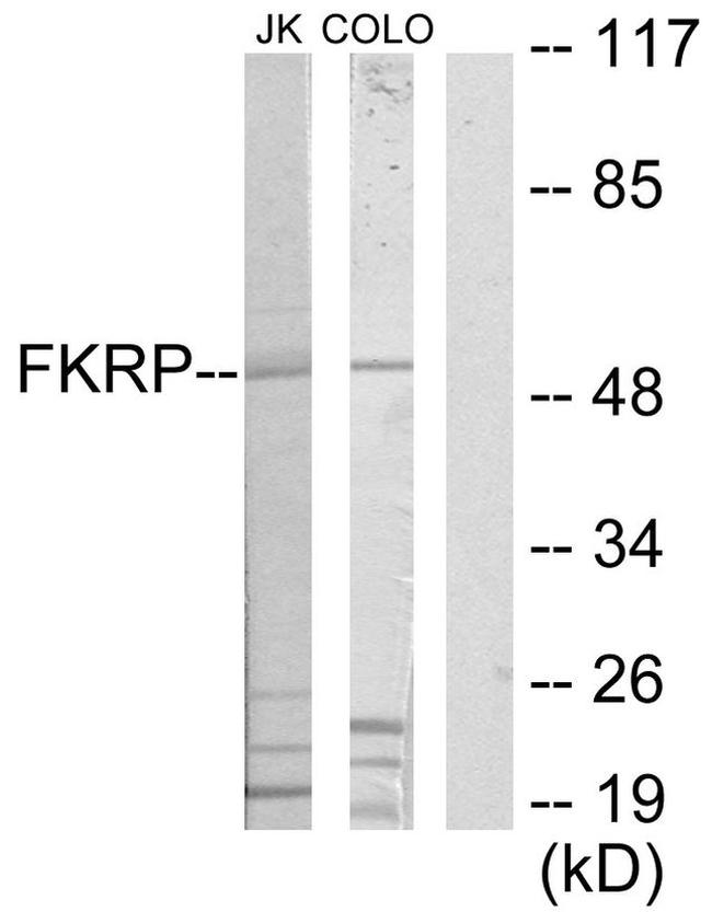 FKRP Antibody in Western Blot (WB)