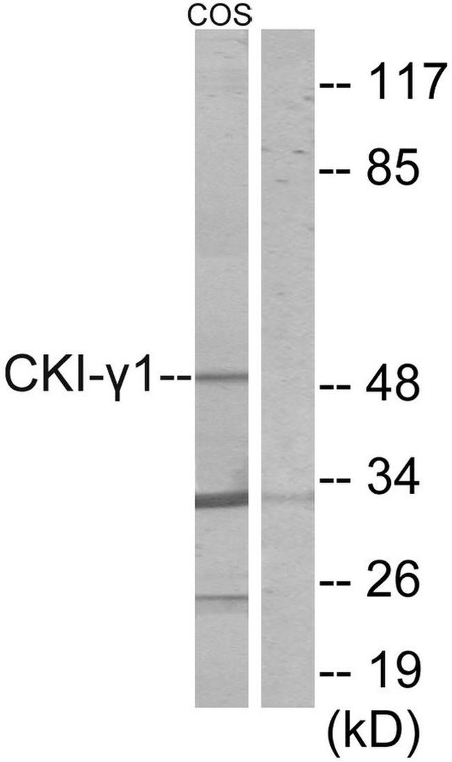 CK1 gamma-1 Antibody in Western Blot (WB)