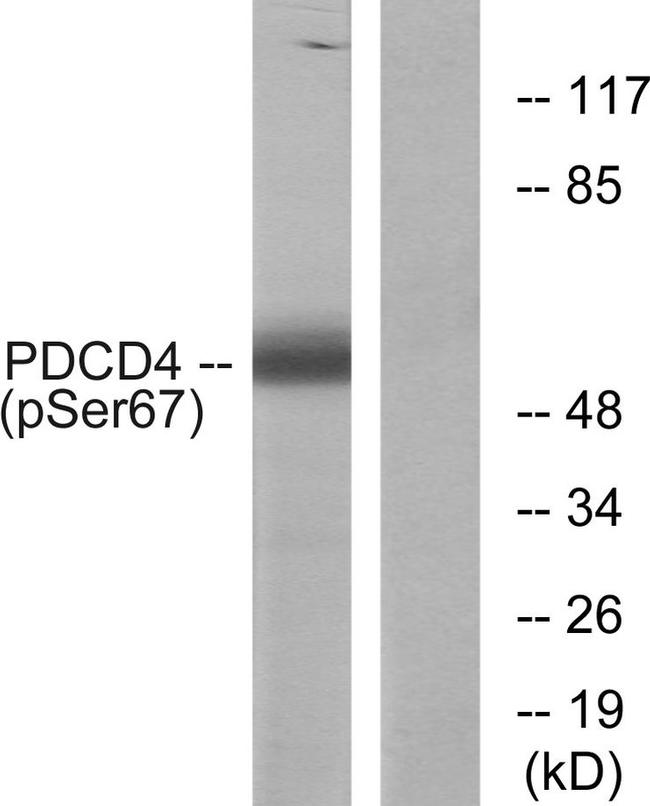 Phospho-PDCD4 (Ser67) Antibody in Western Blot (WB)