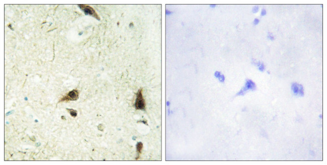 CHRAC1 Antibody in Immunohistochemistry (Paraffin) (IHC (P))