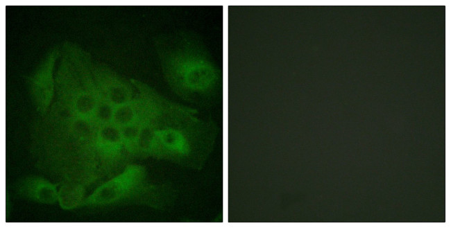 Phospho-PIKFYVE (Ser307) Antibody in Immunocytochemistry (ICC/IF)