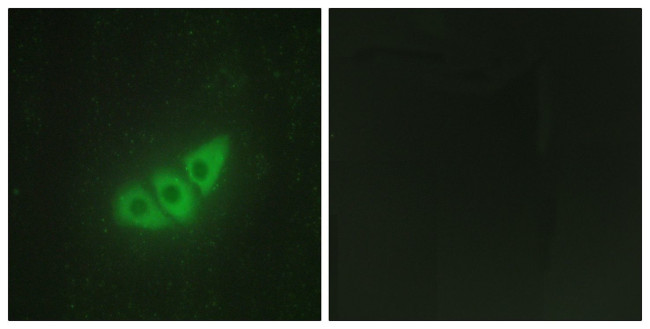 PERK Antibody in Immunocytochemistry (ICC/IF)